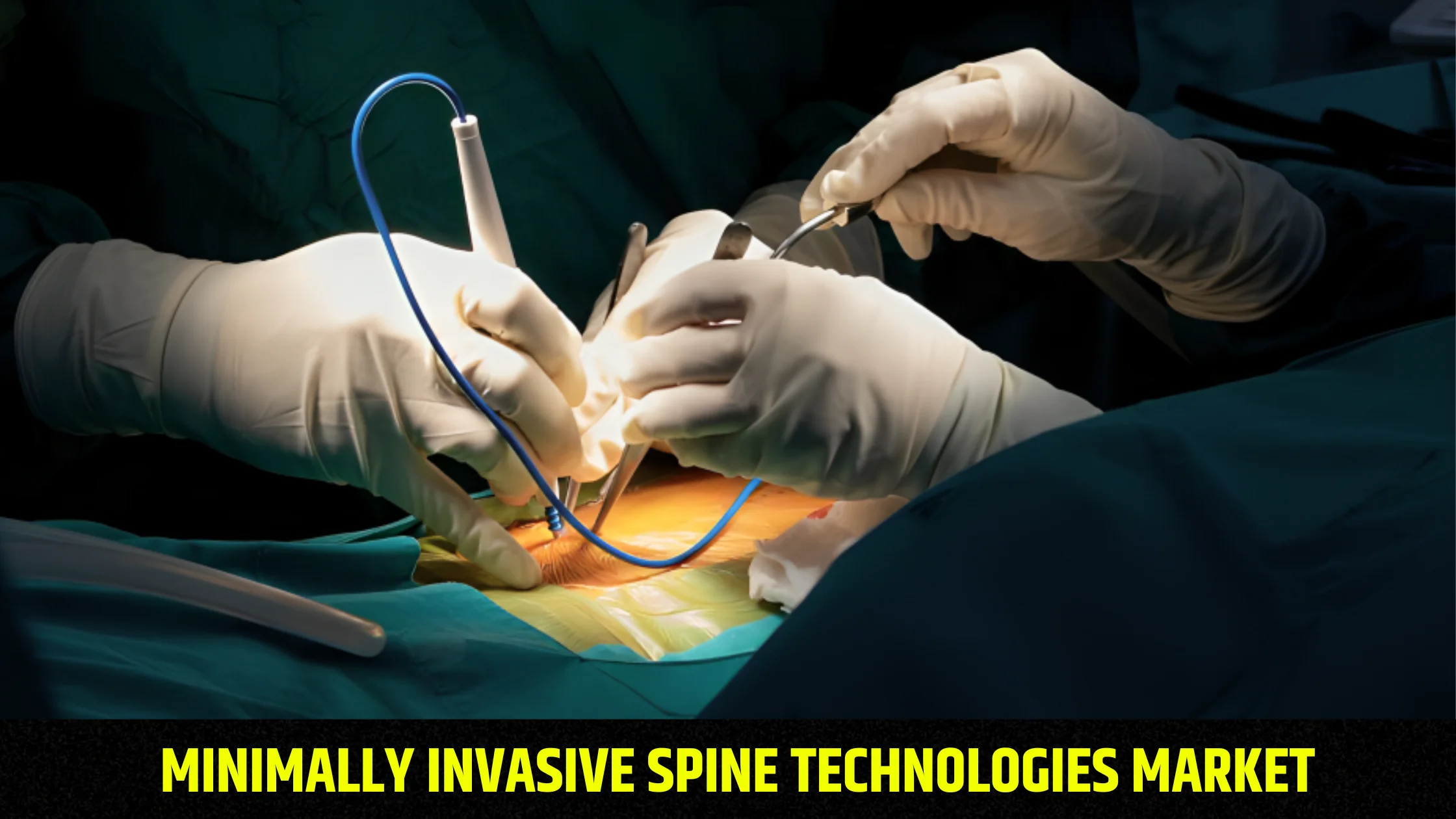 global-minimally-invasive-spine-technologies-market