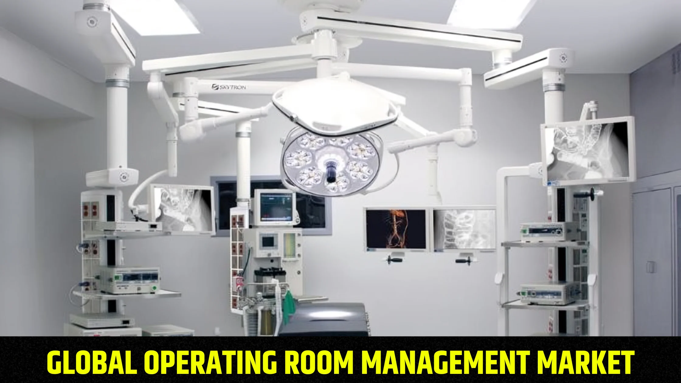 global-operating-room-management-market